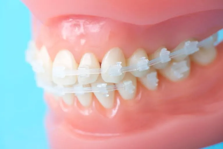 矯正歯科について